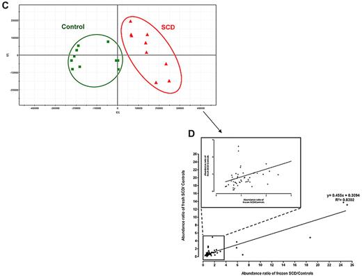 Figure 3. SCD patients and healthy subjects can be individualized on the basis of the metabolic information contained in their RBCs. PCA score plots for RBC extracts obtained from 28 SCD patients and 24 controls. Each point (red triangles and green squares for SCD patients and healthy subjects, respectively) represents an LC/MS metabolic fingerprint. (A) Data acquired in the negative mode of electrospray ionization. The variables contained in the resulting data matrix were mean-centered and scaled to unit variance before PCA. The separation occurs on the first component. (B) Data acquired in the positive mode of ionization. The variables contained in the resulting data matrix were mean-centered and scaled to Pareto variance before PCA. The separation occurs on the second component. (C-D) Impact of the storage of RBC extracts on the metabolic information contained in the LC/MS fingerprints. Blood samples from SCD patients and controls (9 patients, and either 11 or 5 controls, for positive or negative ion mode, respectively) were collected and divided in 2 aliquots, one being immediately extracted and the other frozen,23 before future extraction. (C) PCA scores plot observed with detection in the positive ion mode. (D) Correlation between concentration ratios of SCD patients to controls obtained on fresh and frozen RBC extracts on 34 discriminating metabolites detected in positive ion mode.