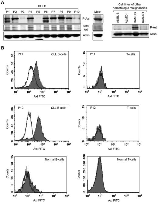 Figure 1. Primary CLL B cells express constitutively P-Axl. (A) Detection of Axl in primary CLL B cells and other hematologic malignancies. Lysates of CLL B cells from patients with CLL (n = 10) and Mec-1 cell line were examined for the presence of P-Axl by Western blot analysis. Expression of total Axl was also examined. Lysates of 3 myeloma cell lines (ANBL-6, ALMC-1, and KAS-6/1) and 1 cell line from Burkitt lymphoma (RAMOS) were also examined for the detection of phospho-Axl in Western blot analysis. Individual patients (P) are indicated and sequentially numbered. Actin was used as loading control. (B) Detection of cell surface Axl. Peripheral blood mononuclear cells from patients with CLL or healthy persons were stained with mouse monoclonal antibodies to CD19 and CD5 conjugated with allophycocyanin or phycoerythrin, respectively, and an unconjugated antibody to human Axl, followed by FITC-conjugated secondary antibody or respective fluorescein-conjugated isotype controls. Cells were washed and analyzed for the expression of Axl by gating CD19+/CD5+ (CLL B cell), CD19+/CD5− (normal B cell) or CD19−/CD5+ (T cell) populations. Histogram overlay diagram of 2 representative patients with CLL (P11 and P12) and 1 healthy control are shown. Black line indicates isotype controls and filled histogram indicates Axl expression.