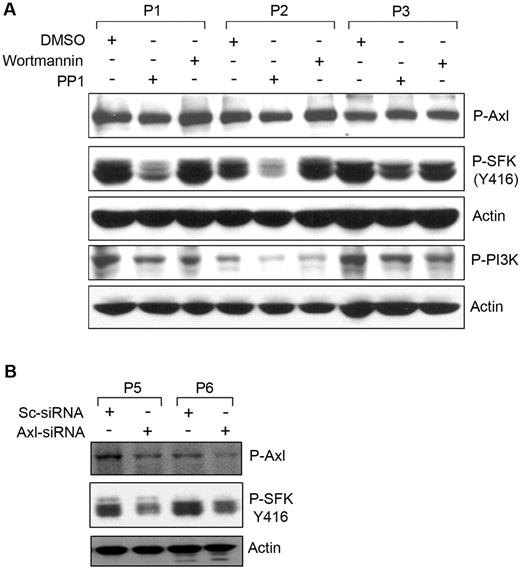 Figure 3. Phosphorylation of Axl is an upstream event of SFK activation. (A) Inhibition of SFK phosphorylation does not alter Axl phosphorylation. Cell lysates from CLL B cells treated with the Src inhibitor (PP1) or PI3K inhibitor (wortmannin) or left untreated were examined for the detection of phosphorylated Axl, SFK, or PI3K by Western blot analysis. Actin was used as loading control. (B) Knockdown of Axl reduces phosphorylation of SFK. CLL B cells were transfected with scrambled siRNA (Sc-siRNA) as a control or Axl-specific siRNA, and cell lysates were analyzed for the detection of phosphorylated Axl and SFK in Western blot. Actin was used as loading control. Patients with CLL are indicated by arbitrary numbers.