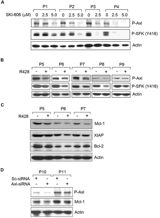 Figure 5. Induction of apoptosis in CLL B cells by SKI-606 or R428 is associated with reduction of Axl phosphorylation. (A) SKI-606 targets Axl and SFK phosphorylation. Primary CLL B cells were treated with SKI-606 at sublethal doses as indicated for 24 hours. Cell lysates were examined for levels of Axl and SFK (Tyr 416) phosphorylation by Western blot analysis. Actin was used as loading control. (B) R428 inhibits Axl phosphorylation. CLL B cells were treated with R428 at a suboptimal dose (based on apoptosis studies) of 1.0μM for 24 hours, and cell lysates were examined for the Axl and SFK phosphorylation by Western blot analysis with the use of specific antibodies. Actin was used as loading control. Patients with patients were indicated by assigning arbitrary numbers. (C) Axl inhibition reduces Mcl-1. R428-treated CLL B-cell lysates (P5-P7) used above (B) were analyzed for the expression of Mcl-1, XIAP, and Bcl-2 by Western blots with the use of specific antibodies. A consistent reduction of Mcl-1 was detected in these cell lysates; however; only a subtle, if at all, or no effects on the expression of XIAP or Bcl-2 was observed on Axl-inhibition. Actin was used as loading control. (D) Knockdown of Axl reduces Mcl-1. CLL B cells were transfected with scrambled siRNA (Sc-siRNA) as a control or Axl-specific siRNA, and cell lysates were analyzed after 48 hours of transfection for the detection of P-Axl and Mcl-1 in Western blot. Actin was used as loading control. Patients with CLL are indicated by arbitrary numbers.