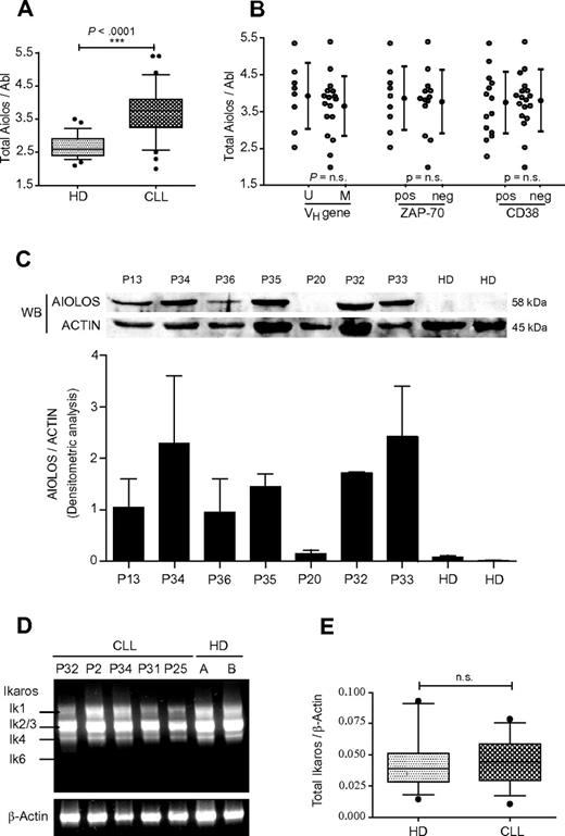 Figure 1. Analysis of Aiolos and Ikaros expression in CLL. (A) Quantification of total Aiolos transcripts in B cells from 32 CLL patients (P1-P18 and P20-P33) and 28 HDs obtained by RT-qPCR of B-cell RNA and normalized to the Abl gene. Absolute quantification of Aiolos and Abl was performed with the use of known quantities of pcDNA3.1-hAio1 construct and Daudi total RNA, respectively. Respective data are summarized and presented as the mean ± SEM. (B) Comparison of Aiolos levels in CLL subsets defined by VH gene mutation status, ZAP-70, and CD38 expression. Respective data are summarized and presented as the mean ± SEM. Differences between groups were tested using unpaired t test (Prism5.0c software; ns indicates non significant; *P < .05; **P < .01; ***P < .001). (C) Aiolos protein levels in PBMCs from 7 CLL patients and 2 HDs were detected by Western blot with a specific anti-Aiolos antibody. Actin was used as internal loading control (top). The histogram shows the densitometric analysis of 2 independent Western blot experiments with same protein samples. The error bars represent standard deviation (bottom). (D) Expression of Ikaros transcripts in PBMC from HD and CLL patients. Representative results of Ikaros isoforms expression in 2 HD and 5 CLL patients (P2, P25, P31, P32, and P34) after one-step RT-PCR amplification of PBMC RNA. β-actin was used as internal control. (E) Quantitative analysis of total Ikaros mRNA levels in B cells from 13 HD and 14 CLL patients (P17, P18, P20-P23, P25, P26, and P28-P33). Data are expressed as normalized expression by use of the 2−ΔCt calculation method (Ct indicates cycle threshold) and β-Actin as reference gene. n.s. indicates nonsignificant; *P < .05; **P < .01; ***P < .001.
