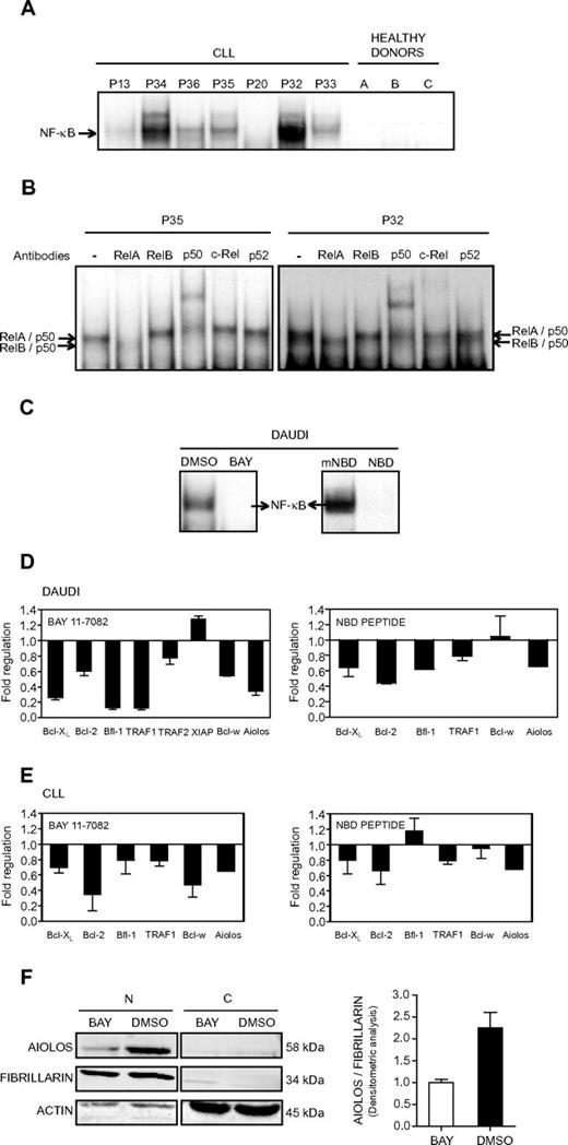 Figure 5. Effect of NF-κB inhibition on Aiolos expression. (A) Analysis of NF-κB DNA-binding activity in B cells from CLL. Electrophoretic mobility shift assays were performed with total extracts from PBMC of 7 CLL patients (P13, P20, and P32-P36) and 3 HD using a 32P-labeled human immunodeficiency virus-long terminal repeat tandem κB oligonucleotide as a probe. (B) For supershift analysis, total extracts from 2 CLL patients (P35 and P32) were incubated with the indicated antibodies before incubation with the labeled probe. (C) Analysis of NF-κB DNA-binding activity in Daudi cells. Electrophoretic mobility shift assays were performed with nuclear extracts from Daudi cells in 3 independent experiments. Daudi cells were treated for 8 hours with the NF-κB inhibitor BAY 11-7082 at 5μM (referred as BAY, left) or for 2 hours with the wild-type NEMO binding domain peptide at 20μM (referred as NBD, right). DMSO or mNBD was used as a control. (D-E) Expression of Aiolos and antiapoptotic molecules in NF-κB inhibitor-treated Daudi and CLL cells. The expression of different genes was analyzed by qRT-PCR and normalized by use of the 2−ΔCt calculation method (Ct indicates cycle threshold) and β-actin as reference gene. Daudi and CLL cells were treated with BAY 11-7082 (5μM, 8 hours; panels D-E left) or NBD peptide (20μM, 2 hours; panels D-E right). CLL cells from 2 (P1 and P37) and 4 (P1 and P38-40) patients were treated with BAY and NBD, respectively. DMSO or mNBD was used as controls. Results are expressed as fold down- or up-regulation of inhibitor-treated cells compared with control cells. Data are mean ± SEM of at least 3 independent experiments. (F) Aiolos expression at the protein level was analyzed by Western blotting in nuclear (N) or cytosolic (C) extracts isolated from Daudi cells treated or not with BAY (5μM, 8 hours). Fibrillarin and β-actin expression were used as internal control of the nuclear and cytosolic fraction purity, respectively. Densitometric analysis of nuclear proteins and molecular weight of the proteins are shown. Similar results were obtained in 2 independent experiments.