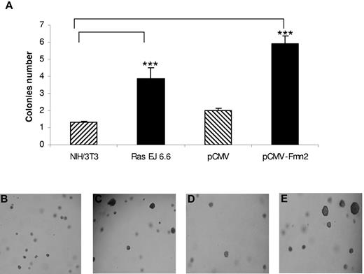 Figure 2. Effect of Fmn2 protein expression on anchorage of NIH/3T3 cells. Cells were transiently transfected with pCMV empty vector, with the pCMV-Fmn2 vector, and the Ras (EJ 6.6) expression vector. Transfected or control cells (104) were plated in soft agar as described in “Colony formation in soft agar.” After 4 weeks, the number of colonies (at least twice larger than colonies from controls) was scored (A). The results represent the average of 3 independent experiments. Statistical analysis was performed using one-way analysis of variance (P < .05). Cells were observed with an optical microscope (Ernst Leitz, 6MBH Wetzlar), and representative fields were photographed using a numerical camera (Nikon coolpix 4500; original magnification ×40). Images were analyzed using NIH ImageJ software Version 1.42l. Cells were left untransfected (B) or transfected with Ras EJ 6.6 (C), empty vector (D), or pCMV-Fmn2 (E).