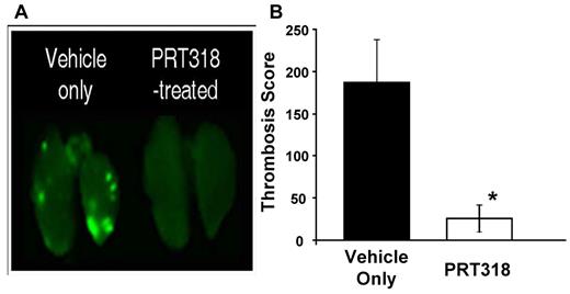 Figure 6. HIT IC-mediated thrombosis in vivo. HIT model mice treated with the HIT-like antibody KKO (20 mg/kg body weight, intraperitoneally) received 2 doses of PRT318 (30 mg/kg body weight) orally via gavage or vehicle only (sterile water). Platelets from donor mice were isolated, labeled with Alexa750-labeled antibodies to GPIX, washed, and injected into HIT model mice one hour before challenge with heparin (1400 U/kg, subcutaneously). Three hours after infusion of heparin, mice were killed, flushed systemically with phosphate-buffered saline, and the lungs were extracted and scanned on a Li-COR Odyssey at 780 nm. (A) Representative images for lungs extracted from mice treated with heparin/KKO in the presence or absence of PRT318. (B) The Thrombosis Score reflects the product of the mean thrombus area (square pixels) and the mean number of thrombi (defined by a signal intensity that is 1.5-fold above the background). The Thrombosis Score is significantly different in vehicle only-treated mice (score = 186.9) versus PRT318-treated mice (score = 25.7). Data are mean ± SEM; n = 6 for each treatment group. *P = .03.