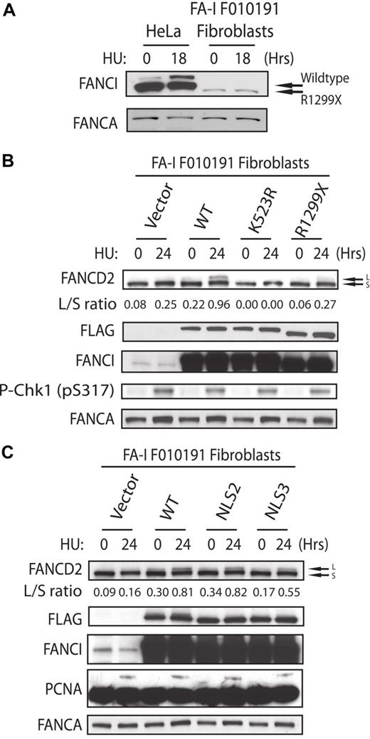 Figure 4. Recovery of FANCD2 monoubiquitination in the FA-I F010191 fibroblasts. (A) HeLa and F010191 fibroblasts were either untreated or treated with HU (2mM for 18 hours). (B-C) F010191 fibroblasts were transfected with empty vector or the indicated FANCI expression constructs. Forty-eight hours after transfection, cells were treated with 2mM HU for 24 hours and FANCD2 monoubiquitination was assessed by Western blot analysis and probed with the indicated antibodies. The L/S ratio was calculated as described in Figure 3A.