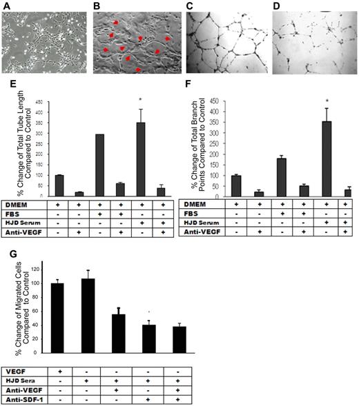 Figure 5. HJD plasma elicits an angiogenic response from ECs that is VEGF-dependent. (A) Endothelial cells incubated with control group A sera for 22 hours showing normal morphology. (B) Endothelial cells incubated with HJD sera for 22 hours revealing the presence of “tube formation” representing blood vessels as indicated by the red arrows. Results replicated 4 times and represent data from 1 experiment. Human umbilical vein endothelial cells grown in DMEM culture medium (10 000/well) were plated on Matrigel-coated 48-well plates with (D) or without (C) preincubation with anti-VEGF antibody (10 μg/mL) and with or without FBS or HJD sera. Images reflected tube formation after 16-hour incubation detected by phase-contrast microscopy (original magnification ×40). Representative results from 4 experiments. Quantitative assessment of mean and total tube lengths and branch points using Metamorph software Version 40002 (Molecular Devices) revealed an 84% reduction in total tube length (SEM). *P < .001. (E) An 82% reduction in mean (SEM) tube length (data not shown). P < .001. A 93% reduction in mean (SEM) branch points. P < .001. (F) Representative results from 3 experiments. Migration across a transwell barrier was induced by VEGF and HJD serum and abrogated by anti-VEGF and anti–SDF-1 antibody. When human umbilical vein endothelial cells were plated on 24-well plates with or without VEGF, HJD serum, anti-VEGF blocking peptide, or anti-SDF-1 antibody, a 55% reduction in human umbilical vein endothelial cell migration with anti-VEGF antibody and a 60% reduction with anti-SDF-1 antibody (P < .01) was observed. There was no additive effect of anti-VEGF and anti–SDF-1 antibodies. (G) Results are expressed as a percent of the control, which is human umbilical vein endothelial cells grown in the presence of VEGF. Representative results from 3 experiments.