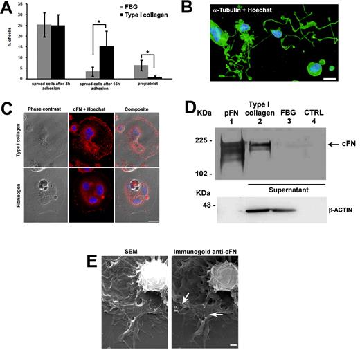 Figure 2. cFN modulates MK adhesion on collagen type I, but not on fibrinogen. Mature MKs were differentiated from human cord blood CD34+ cells as described in “Methods.” Mature MKs were then incubated on type I collagen or fibrinogen-coated coverslips for 16 hours at 37°C in an atmosphere of 5% CO2 in the presence of TPO. (A) After 3 and 16 hours of incubation, coverslips were fixed and MK spreading and pro-platelets were evaluated as described in “Methods.” (B) Representative image of MK forming pro-platelets upon fibrinogen adhesion. Cells were stained with an anti–α-tubulin antibody (green) and Hoechst 33288 for nuclear staining (blue). Scale bar = 20 μm. (C) After 3 hours of incubation, coverslips were fixed, permeabilized, and stained with a polyclonal antibody against cFN. Subcellular localization of cFN (red) was analyzed by confocal microscopy. Scale bar = 10 μm. (D) Immunoprecipitation of released FN in supernatants harvested after 3 hours of MK adhesion to type I collagen (lane 2) or fibrinogen (lane 3). FN from human plasma was used as a positive control (lane 1), while unconditioned StemSpan medium was used as a negative control (lane 4). Actin was revealed by Western blotting in adherent cells on both matrices to ensure the same number of cells. (E) Scanning electron microscopy of MKs spread on type I collagen after 3 hours of incubation. Right panel, immunogold staining with polyclonal FN antibody. Arrows indicate FN exposure on the MK membrane. Scale bar = 1 μm. *P < .05