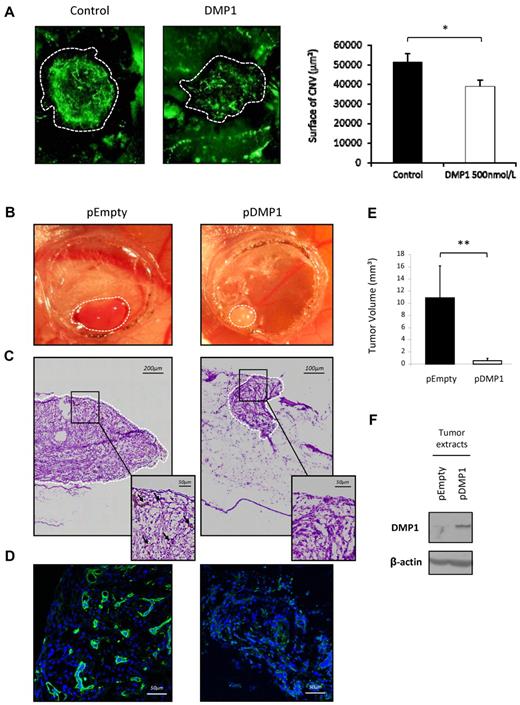 Figure 6. DMP1 impairs in vivo angiogenesis in the CNV model and its overexpression decreases glioma tumor growth and tumor angiogenesis in vivo. (A) Mice were injured by laser shots onto the retina (areas within the dotted lines) and were then subjected to intravitreous injection of DMP1 (500 nmol/L). Eyes were removed after 7 days and the angiogenic response was measured, as described in “Methods.” The quantification represents the measure of total vessel fluorescence surface for each impact. Error bars represent the means ± SEM of 20 impacts of a representative experiment (n = 2). *P ≤ .05 vs control vehicle. (B) The growth of both DMP1-overexpressing (pDMP1) and control (pEmpty) tumors on CAM was documented by biomicroscopy at day 5 after U87-MG cell grafting. A representative tumor for each condition is shown. DMP1 tumors appeared completely white compared with control, in which blood vessels can be seen under the surface. (C) H&E photos of the tumors shown in panel B were taken right under the surface of the tumor (magnification, 40×). Numerous irregular and dilated capillaries (black arrows in the enlarged insert) were visible in control pEmpty tumors but not in DMP1-overexpressing tumors. (D) Specific fluorescein isothiocyanate–lectin staining was used for visualization of blood vessels in the tumors shown in panel B, which confirmed the avascular phenotype of DMP1-overexpressing tumors compared with control pEmpty tumors. Nuclei appear blue after TO-PRO-3 staining (magnification, 40×). (E) Tumor volume was calculated 5 days after grafting for each condition, as described in “Methods.” DMP1 overexpression induced a significant decrease of tumor volume compared with the controls. Results are expressed as the means ± SD of 6 replicates of a representative experiment (n = 3). **P ≤ .005 vs pEmpty. (F) Western blot analysis with an antibody to DMP1 on tumor lysates showing that pDMP1 tumors expressed significantly more DMP1 than control pEmpty tumors.