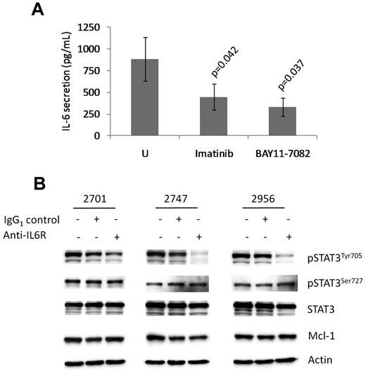 Figure 5. c-Abl-activated NF-κB in CLL cells causes autocrine IL-6 expression and STAT3 Y705 phosphorylation. (A) Enzyme-linked immunosorbent assay measurement of IL-6 secretion from CLL cells cultured for 6 hours in the absence of inhibitor (U), or in the presence of either 20μM imatinib or 2μM BAY11-7082. The results are representative of 4 different CLL patient samples and are presented as mean ± SEM. (B) Blocking the IL-6R inhibits IL-6 secretion and Y705-STAT3 phosphorylation. CLL cells from 3 different cases were incubated in the presence or absence of 0.5μM anti–IL-6R antibody or an IgG1 isotype control for 12 hours. Lysates of these cells were then probed by Western blot with the indicated antibodies.