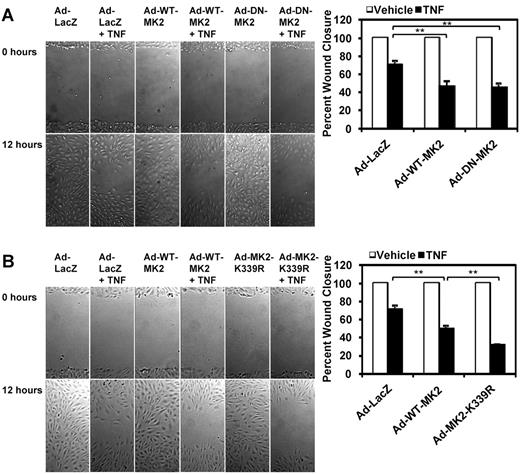 Figure 6. TNF-α–mediated inhibition of EC migration is enhanced by the loss of MK2 SUMOylation. (A-B) HUVECs were transduced with the appropriate adenoviral constructs (Ad-LacZ, Ad-WT-MK2, Ad-DN-MK2, or Ad-K339R) for 24 hours. Confluent monolayers were “wounded” with a P200 pipette tip and wound closure in the presence or absence of TNF-α (10 ng/mL) was recorded using time-lapse microscopy at 5 different locations per sample for 12 hours with a 30-minute interval. Quantification for the percenthe percentage wound closure can be seen on the right. Note the inhibition by TNF-α on wound closure. Also note the similar effects of Ad-WT-MK2 and Ad-DN-MK2 on enhancing TNF-α–mediated inhibition of wound closure (A). This effect was further enhanced by Ad-MK2-K339R under TNF-α stimulation compared with Ad-WT-MK2 (B). (A-B) Representative images from 1 of 3 independent experiments and quantitative data are shown (n = 3). Values are means ± standard deviation. *P < .05; **P < .01.