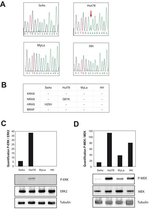 Figure 2. CTCL cell line Hut78 harbors Q61K mutation for NRAS. (A) RNA was isolated and reverse transcribed to cDNA for all 4 cell lines. Next, PCR was performed covering the open reading frame of KRAS, NRAS, HRAS, and BRAF. PCR products were purified and sent for sequencing. Results were evaluated by Genetic Analysis Technology Consortium sequence viewer. Arrow indicates cytosine-to-adenosine conversion. (B) Table of sequencing results for all 4 CTCL cell lines. A heterozygous Q61K mutation was detected for the Hut78 cell line. A homozygous silent H25H mutation was found in the SeAx cell line. (C) All 4 cell lines were kept under equal conditions, lysed, and and lysates subjected to Western blot. Phosphorylation of ERK was assayed by anti-phospho-specific ERK antibodies. Equal expression of ERK was verified by anti-ERK2 antibodies, and equal loading was verified by anti–tubulin antibodies. Quantification of phosphorylated ERK to ERK2 was done with ImageJ 1.43 Quantification software. (D) Same as panel C, but anti-phospho-specific MEK antibodies and anti-MEK antibodies were used to assess the phosphorylation status of MEK and MEK expression, respectively. Equal loading was verified by antitubulin antibodies.