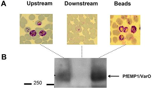 Figure 5. Sorted RBC subsets are amenable to further immunochemical characterization. (A) Giemsa-stained blood films of upstream, retained/retrieved from microbeads, and downstream samples showing the total retention of schizonts expressing VarO protein. (B) Pooled extracts of upstream, retained/retrieved, and downstream samples analyzed by a Western blot probed with mouse anti-VarO immune serum.