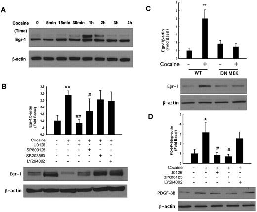 Figure 3. Egr-1 expression is up-regulated in HBMECs exposed to cocaine. (A) Cocaine induced time-dependent activation of Egr-1 expression in HBMECs. (B) Pharmacologic inhibition of ERK and JNK pathways by MEK (U0126) and JNK (SP600125) inhibitors resulted in amelioration of cocaine-mediated induction of Egr-1. (C) Transfection of cells with DN-MEK but not WT-MEK resulted in abrogation of cocaine-mediated induction of Egr-1. (D) Pretreatment of cells with MEK (U1026) and JNK (SP600125) but not PI3K (LY294002) inhibitors resulted in amelioration of cocaine-mediated induction of PDGF-BB. All data are presented as mean ± SD of 3 individual experiments. *P < .05, **P < .01 vs control group; #P < .05, ##P < .01 vs cocaine-treated group.