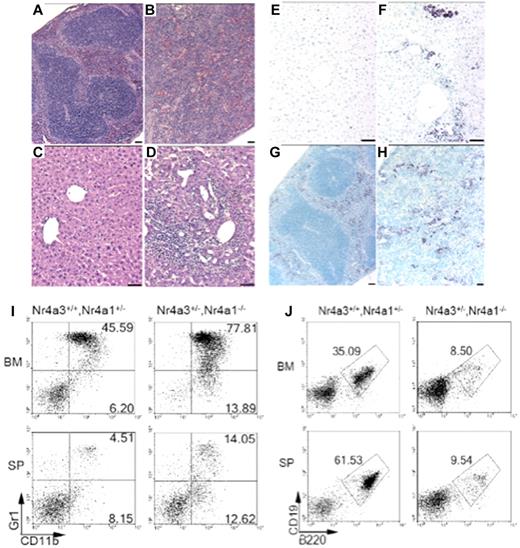 Figure 4. Perivascular infiltrations and lymphoid tissue disruption resulting from abnormal myeloid dissemination and increased myelopoiesis in hypoallelic mice. Hematoxylin and eosin-stained paraffin sections of spleen (A-B) and liver (C-D). Spleen from a healthy littermate (A) and an MDS/MPN NR4A1+/−NR4A3−/− mouse (at 6 months; B) revealed loss of distinct splenic architecture, including well-defined red and white pulp. Histologic analysis of livers from a healthy littermate (C) and an MDS/MPN NR4A1+/−NR4A3−/− mouse (at 6 months) (D) showed large regions of perivascular infiltration. Scale bar represents 50 μm (60×/1.25 objective magnification). (E-H) Antimyeloperoxidase immunohistochemistry revealed myeloid contribution to infiltrates in the liver (F) and spleen (H). These infiltrates were not present in control liver (E) or spleen (G). Scale bars represent 50 μm. (I-J) Representative dot plots from flow cytometric analysis of BM and spleen (SP) demonstrate an increase in myeloid cells (CD11b+/Gr-1− and CD11b+/Gr-1+) in diseased mice compared with healthy littermates (I). A decrease in the percentage of B-lymphocytes (B220+/CD19+) was also noted in diseased mice compared with healthy littermates (J). Numbers shown are the average percentage of total cells for the associated region (averaged from n = 4 mice per genotype; age range, 9-12 months).