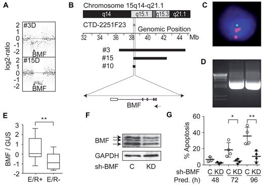 Figure 2. BMF deletions and functional consequences of reduced BMF expression in E/R-positive ALL. (A) Log2-ratio copy numbers of genomic deletions encompassing BMF (indicated by an arrow) are shown for 2 patients with a deletion at 15q15.1. (B) Segmental deletions at 15q15.1 in 3 cases (3, 10, and 15). (Top) A partial ideogram of the 15q region and the position of the FISH probe used for confirmation of the deletions. The scale indicates genomic positions of the deletions in megabases according to the University of California Santa Cruz Genome Browser (NCBI Build, Version 36.1). Each black horizontal bar represents a deletion in a single patient as inferred by SNP array. Vertical lines indicate the overlapping region encompassing the only commonly deleted gene (BMF) (bottom). (C) Verification of the BMF deletion by FISH in patient 10 in 57% of nuclei (green represents BMF; and red, chromosome 15 centromer). (D) Genomic breakpoint of the BMF deletion from case 10 was cloned (details provided in supplemental data; accession code #GU984796) and sequence information used for nested PCR. The resulting PCR products from initial diagnosis (middle lane) and relapse (right lane) are shown. Left lane indicates size marker. (E) Quantification of BMF expression in E/R-positive (E/R+, n = 15) and E/R-negative (E/R−, n = 15) BCP ALL cases without relapse. Data represent relative expression values of BMF compared with GUS. Boxes include values between the 25th and 75th percentile, and whiskers indicate the minimal and maximal values. The black line indicates the median BMF expression of all samples. For statistical evaluation, Welch unpaired t test was used. (F) Western blot analysis of REH cells on BMF repression by RNAi. Protein lysates were prepared from green fluorescent protein-sorted cells expressing the shRNA vector targeting human BMF (KD) or a nontargeting control shRNA (C). BMF isoforms (BMF1, BMF2, and BMF3, top-down) are marked with arrows. GAPDH levels were used as a loading control. (G) Glucocorticoid-induced apoptosis on BMF repression in REH cells. BMF silenced cells were treated with prednisolone for the indicated times, and apoptosis was assessed by annexin V/propidium iodide staining in green fluorescent protein-positive cells carrying the lentiviral shRNA construct. Apoptosis was calculated by subtraction of annexin single-positive cells in untreated from prednisolone-treated cells. Percentages of 4 independent experiments from 3 separate infections are shown. Bars represent mean ± SD. *P < .05 (paired Student t test). **P < .01 (paired Student t test).