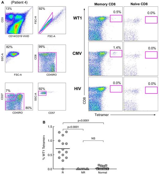 Figure 3. Frequencies of memory CD8+ T cells that bind the WT1126-134/HLA-A*0201 tetramer are greater in IST responders compared with nonresponders. (A) Gating strategy and an example of tetramer binding are shown (patient 4; supplemental Table 1). Live T cells were separated from dead cells, B cells, and monocytes in a CD14/CD19/ViViD (dump channel) versus CD3 bivariate plot, and single cells were identified in a FSC-A versus FSC-H plot. Intact lymphocytes were next identified in an FSC-A versus SSC-A plot. Fluorochrome aggregates were subsequently excluded from the analysis in a CD45RO versus CD8 plot. Naive cells were identified within the CD8+ T-cell pool as CD27+CD45RO−CD57− cells (bottom panels); memory CD8+ T cells were identified within the L-gate shown in the CD27 versus CD45RO plot. Binding of the WT1126-134/HLA-A*0201 tetramer was observed in the memory CD8+ T-cell compartment but not in naive or CD8− memory T-cell populations (top right panels). The HIV p17 Gag77-85/HLA-A*0201 and CMV pp65495-503/HLA-A*0201 tetramers were used as negative and positive controls, respectively. (B) The mean frequency of memory CD8+ T cells binding to the WT1126-134/HLA-A*0201 tetramer in IST responders was significantly higher compared with IST nonresponders (P < .0001) and healthy controls (P < .0001). R, responders; NR, nonresponders; Normal, healthy controls.