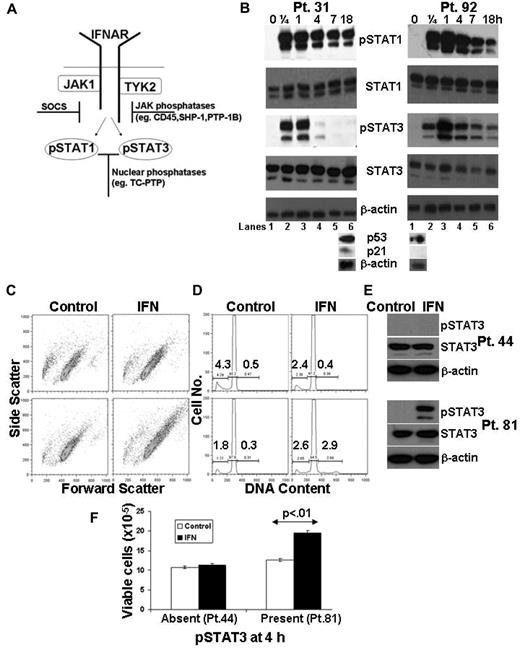 Figure 1. Variations in IFN-mediated STAT3 phosphorylation and proliferation in CLL cells. (A) Schematic diagram of IFN-signaling. (B) Primary CLL cells were treated with IFN-α2b (1000 U/mL) for the indicated times, and whole cell lysates were immunoblotted with antibodies to phosphotyrosine 701-specific STAT1 or phosphotyrosine 705-specific STAT3, as well as total STAT1, STAT3, and β-actin as loading controls. Cell aliquots were also exposed to ionizing radiation (2.5 Gy) and p53 and p21 levels were determined by immunoblotting 18 hours later (bottom blots). Tumor cells from Pt. 31 and Pt. 92 had intact and absent p53 axes, respectively, according to this assay.19 (C) Tumor cells from 2 other patients (Pt. 81 bottom, and Pt. 44 top) were cultured for 4 days in the presence or absence of IFN. Cell size was determined by the forward scatter parameter of flow cytometry. (D) DNA content was also determined by flow cytometry at this time. The number on the right of the histogram represents the percentage of cells with DNA content greater than 2N and the number on the left represents the percentage with subdiploid DNA content.39 (E) Immunoblots showing measurable pSTAT3 levels at 4 hours in CLL cells from Pt. 81 but not Pt. 44. F. Viable cells were counted in a hemocytometer after 4 days of culture. The results show that IFN induced a proliferative response when STAT3 phosphorylation persisted longer than 4 hours.