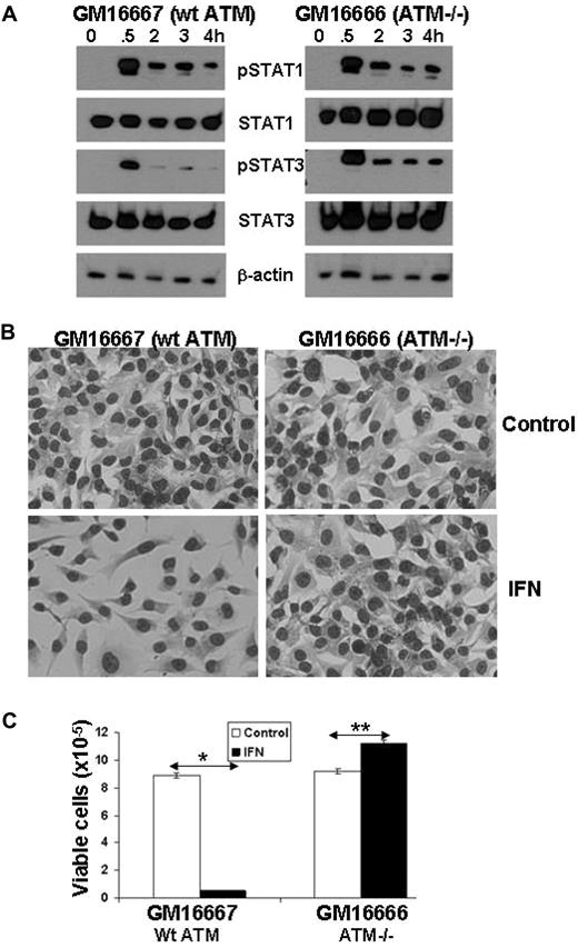 Figure 4. Increased IFN-mediated STAT3 phosphorylation and proliferation in ATM−/− cell lines. (A) GM16667 (wt ATM) and GM16666 (absent ATM) cells in exponential growth phase were treated with IFN-α2b (1000 U/mL) for the indicated times, and whole cell lysates were then immunoblotted with antibodies to phosphotyrosine 701-specific STAT1, phosphotyrosine 705-specific STAT3, total STAT1 and STAT3, or β-actin. (B) After 3 days of culture, the cells were stained and images were taken at a magnification of ×10. Pictures were taken with a Canon PowerShot G11 Digital Camera equipped with a Carl Zeiss 426126 lens. The microscope was an Axiovert 40 C equipped with an A-plan 10×/0.25 objective, both from Zeiss. (C) The cells were also counted manually in a hemocytometer. The average (+ SE) of 3 separate measurements is shown and the experiment was performed twice with similar results. *P < .01; **P < .05