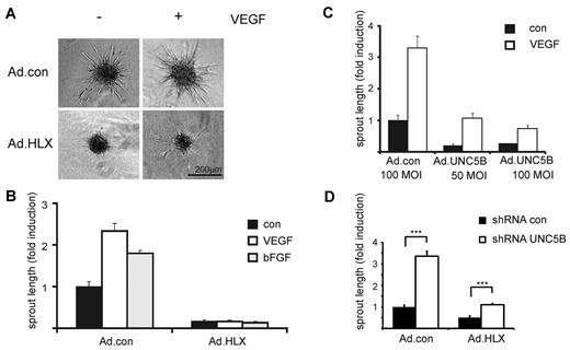 Figure 4. HLX causes strong inhibition of sprouting which is mediated to a significant part by UNC5B. HUVECs were infected with Ad.HLX, Ad.UNC5B, or Ad.con. The following day spheroids of infected and noninfected endothelial cells were generated as described in “Spheroid-based in vitro angiogenesis assay.” The spheroids were embedded into collagen gels and induced with VEGF or bFGF (25 ng/mL) or cultured without cytokine stimulation. After 24 hours, the spheroids were fixed and photographic images were taken for quantification. (A) Representative images of spheroids generated from Ad.HLX- or Ad.con-infected cells (10 MOI) and induced with VEGF (+) or left untreated (−) are displayed. (B) Quantification of inhibition of sprouting by overexpression of HLX: analyses of sprout lengths were performed by measuring the total lengths of sprouts for 10 spheroids each on microscopic images using the ImageJ software (http://www.uhnres.utoronto.ca/facilities/wcif/imagej/). Results are displayed as mean values ± SEM of the fold induction of sprout lengths observed compared with noninduced samples infected with control viruses (arbitrarily set to 1). One representative experiment of 4 performed is shown. (C) Quantification of inhibition of sprouting by overexpression of UNC5B: Analyses were as described in panel B. One representative experiment of 3 is shown. (D) Quantification of increase in sprouting by down-modulation of UNC5B in endothelial cells infected with Ad.con or Ad.HLX: HUVECs were first transduced with lentiviruses for control shRNA or shRNA targeted against UNC5B. After 1 day, cells were also infected with 15 MOI of Ad.con or Ad.HLX. The following day, spheroids were prepared and the next day incorporated into collagen gels in the presence of VEGF-A. Total sprout lengths of 15 spheroids each were measured. The shown values are calculated from 4 independent experiments and display the relative sprout length ± SEM in comparison to the samples transduced with Ad.con and shRNA.con. ***P < .001, t test.