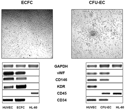 Figure 1. Representative images of CFU-EC and E-CFC colonies and the typical RNA transcript, assessing the hematologic derivation of CFU-ECs and the true endothelial origin of the E-CFCs. GAPDH indicates glyceraldehyde-3-phosphate dehydrogenase; VWF, von Willebrand factor; HUVEC, human umbilical vein endothelial cell.