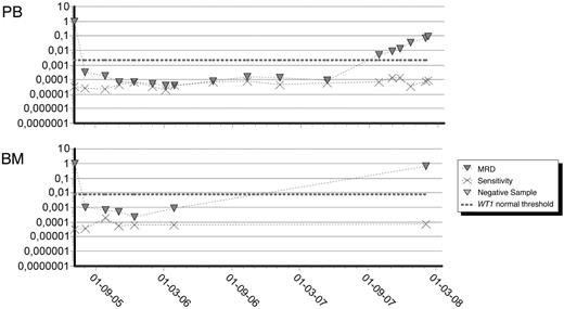 Figure 4. Follow-up during therapy, CR, and relapse of a WT1+ patient treated at our department. x-axis represents time since diagnosis; y-axis represents WT1 expression shown as fraction of the expression at diagnosis.