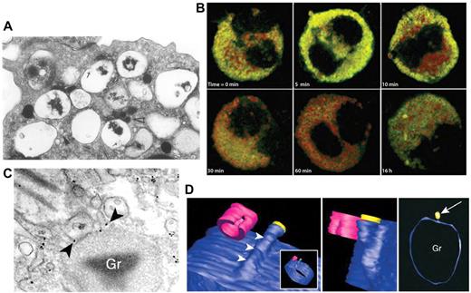 Figure 3. Piecemeal degranulation from eosinophils. (A) Piecemeal release of crystalloid granules with a “hollowed out” appearance, shown by electron microscopic analysis of human cultured eosinophils. Arrows show lucent vesicles budding into granule interior, suggestive of vesicular trafficking to and from crystalloid granules. Reprinted from Am J Pathol. 1991;138:69-82 with permission from the American Society for Investigative Pathology.56 (B) Time course of IFNγ-induced CCL5/RANTES release (green) by piecemeal degranulation from major basic protein-positive crystalloid granules (red) in eosinophils. This research was originally published in Blood.57 Copyright The American Society of Hematology. (C) Immunogold labeling of IL-4 (arrowheads) present in small vesicles budding from a crystalloid granule (Gr), indicating piecemeal degranulation as a pathway for cytokine release. Reproduced with permission from Spencer et al.58 (Cytokine receptor-mediated trafficking performed IL-4 in eosinophils identifies an innate immune mechanism of cytokine secretion. Proc Natl Acad Sci U S A. 2006;103(9):3333-3338. Copyright 2006 National Academy of Sciences, USA.) (D) Meshed model of an eosinophil granule with small vesicles budding from it, using contours generated by automated electron tomography. A protrusion can be seen progressively emerging from the granule, in blue (arrowheads). In the center panel, a vesicle is shown in yellow to indicate the way in which vesicles dissociate from the granule. In the right panel, the arrow indicates the same vesicle from a different perspective near the granule (Gr). This model was generated by meshes of contours arising from serial sections of the same granule in a single cell. Cells were fixed and processed for conventional transmission electron microscopy after stimulation with eotaxin. Images were reproduced from Melo et al.59 Reprinted with permission from Traffic. 2005;6:1047-1057, published by John Wiley and Sons.