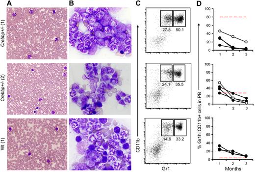 Figure 4. The microenvironment in Crebbp+/− mice does not induce leukemogenesis. Presented are 2 of 4 primary Crebbp+/− recipients (top 2 horizontal rows) and 1 of 4 wild-type controls (bottom row). (A) PB smears (BX41 microscope; Olympus DP71 Digital Imaging System) at a magnification of 40×. (B) BM touch preparations at a magnification of 100×. (C) FACS profiles of donor-derived Gr-1loCD11b+ and Gr-1hiCD11b+ myeloid cells in the BM. (D) Frequencies of donor-derived, wild-type Gr-1hiCD11b+ granulocytes in the PB of wild-type (●) and Crebbp+/− secondary recipients (○). The dashed red line represents the frequency of wild-type myeloid cells in the PB of the primary recipient from which BM was obtained for these secondary recipients.