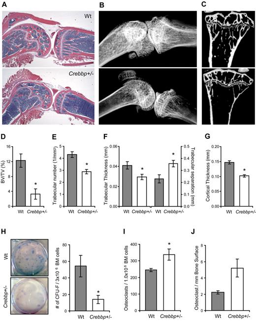 Figure 5. Crebbp+/− mice have decreased bone volume. (A) Representative histological sections of tibiae and femurs stained with H&E from 3- to 4-month-old wild-type (Wt) and Crebbp+/− mice (BX41 microscope; Olympus DP71 Digital Imaging System) at a magnification of 1.25×. (B) Representative radiographic images and (C) microCT 2D slices of tibiae from the same groups of mice. (D-G) MicroCT measurements in the proximal tibia for BV/TV (*P = .007) (D), trabecular number per cubic millimeter (*P = .003) (E), trabecular thickness in millimeters (*P = .044) and separation between trabeculae in millimeters (*P = .028) (F), and cortical bone thickness in millimeters (*P = .0007) (G). (D-G) Data represent means ± SEM (n = 3-5) from 3- to 4-month-old Wt and Crebbp+/− mice. (H) Representative images of CFU-Fs produced from Wt and Crebbp+/− BM and the average number ± SEM of CFU-Fs per 3 × 106 BM cells (n = 3). For each experiment, BM from 3 mice was combined (*P = .031). (I) Average number ± SEM of osteoclasts produced by 1 × 106 Wt and Crebbp+/− BM cells (n = 5; P = .031). (J) Number of osteoclasts per millimeter of bone surface in Wt and Crebbp+/− mice (n = 3-5 mice; P = .058).