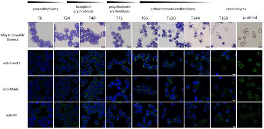 Figure 1. Intracellular pools of band 3, RhAG, and Rh are visible early in erythropoiesis. The top panel represents cells removed from cultures at the indicated time points during differentiation and cytospin and stained with May-Grünwald-Giemsa. Scale bar represents 10 μm. For immunofluorescence, cells were fixed in 0.5% acrolein, cytospun onto Cell-Tak–coated coverslips, and permeabilized using 0.05% Triton X-100. Cells were stained with antibodies against band 3 (BRIC170), RhAG (LA1818), and Rh (BRIC69) as indicated and visualized using goat anti–mouse-Alexa 488. Nuclei were stained with 4′,6-diamidino-2-phenylindole. Scale bar represents 5 μm. T = time in hours.