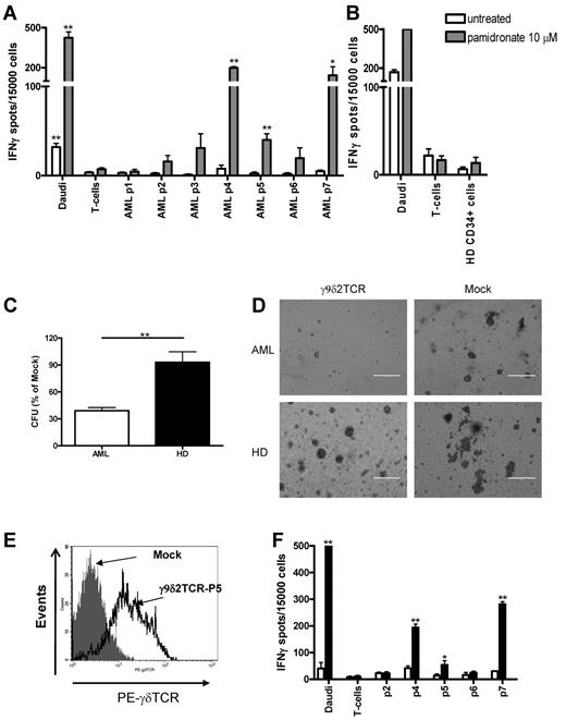 Figure 5. Specific recognition of the primary AML blasts by γ9δ2TCR-transduced αβT cells. (A) γ9δ2TCR-transduced αβT cells of healthy donor were incubated with AML blasts without (□) or with 10μM pamidronate () for 48 hours at E:T ratio of 0.3:1. IFNγ secretion was measured by ELISPOT. Daudi and αβT cells were used as positive or negative target control, respectively. Shown is the result of the mean of 2 experiments performed in duplicates for the same donor. Similar results were observed for 2 other healthy donor-derived γ9δ2TCR-transduced αβT cells. *P = .05, **P < .01. (C) γ9δ2TCR or mock-transduced αβT cells were incubated with AML blasts or PBMCs of healthy donors enriched with CD34+ cells for 4 hours at E:T ratio 4:1. Then cells were plated in methylcellulose and, after 10 days, colony formation was quantified using an inverted microscope. Shown is the percentage of CFU formed after the incubation with γ9δ2TCR-transduced cells, while CFU formed after the incubation with mock-transduced αβT cells is used as 100%. Shown is 1 of 3 representative experiments, which have been performed with different donors. (D) Microscopic photographs of the representative field of methylcellulose colony formation cultures of AML and healthy donor taken on the same day of the assay. (E-F) αβT cells of AML patient 5 were isolated with CD3-specific beads and transduced with γ9δ2-TCR with standard procedures. After selection and expansion, αβT cells were stained with γδTCR-specific Ab and the expression was assessed by FACS analysis. IFNγ secretion in response to AML cells and the control targets was analyzed by ELISPOT as described in panel B.