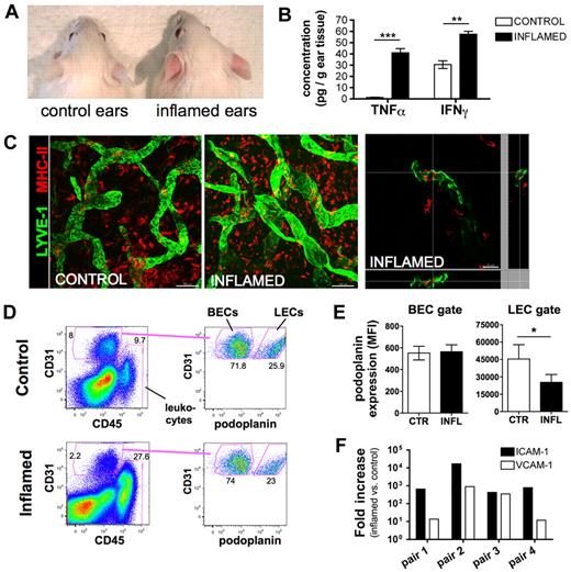 Figure 1. Isolation of LECs from uninflamed and CHS-inflamed mouse ears. (A) A CHS response toward oxazolone was induced in the ears of WT mice. Twenty-four hours after induction, CHS-challenged ears were markedly red and swollen. (B) IFN-γ and TNF-α protein levels were significantly increased in CHS-inflamed ears (n = 3 mice per group). **P < .01. ***P < .001. (C) Whole-mount immunofluorescence of inflamed and control ears detected large numbers of MHCIIhigh cells (red) around (middle panel) and within (right panel, orthogonal slice produced by confocal microscopy) LYVE-1-positive lymphatic vessels (green) in inflamed mouse ears. Scale bars represent 100 μm (left and middle) and 20 μm (right). (D) Ear tissues were digested enzymatically and stained for CD45, CD31, and podoplanin to differentiate between leukocytes (CD45+CD31−), BECs (CD45−CD31+podoplanin−), and LECs (CD45−CD31+podoplanin+). LECs were isolated from ear single-cell suspensions by FACS sorting. (E) Podoplanin was significantly down-regulated in inflamed LECs (INFL) compared with control LECs (CTR), as demonstrated by analysis of the median fluorescent intensity (MFI) of podoplanin expression found on cells in the LEC gate. *P < .05 (paired Student t test). (F) RNA was extracted from sorted LECs. cDNA was synthesized and subjected to one round of linear amplification. LEC preparations isolated from control ears or inflamed ears that were processed in parallel were treated as pairs. The induction of ICAM-1 and VCAM-1 in pairs of control and inflamed samples was analyzed by quantitative PCR.