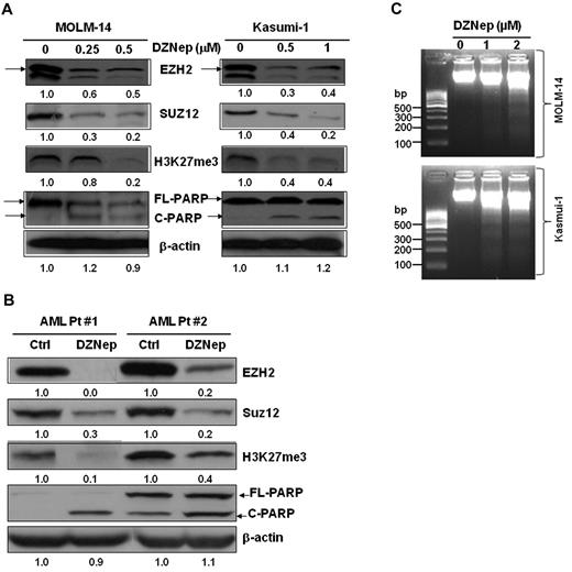 Figure 2. DZNep decreased the protein expression of EZH2, Suz12, H3K27me3, and induced cleaved PARP in leukemia cells. (A) MOLM-14 and Kasumi-1 cells were incubated with 0.1% DMSO, DZNep 0.25μM, 0.5μM, and 0.1% DMSO, 0.5μM, 1μM, respectively, for 48 hours. (B) Primary AML cells were treated with DZNep 5μM for 48 hours. Cells were harvested, lysed, and subjected to immunoblot analysis with primary Abs indicated. β-actin was used as loading controls. Densitometric analysis was performed using Amersham Image Scanner with LabScan ImageQuant TL Software (Amersham Biosciences). The expression ratio of EZH2, Suz12, and H3K27me3 was calculated as the DZNep-treated samples relative to control samples after normalization with respective β-actin level. Arrows indicate EZH2; C, cleaved; and FL (full-length), PARP protein, respectively. (C) Effect of DZNep on DNA fragmentation in MOLM-14 and Kasumi-1 cells.