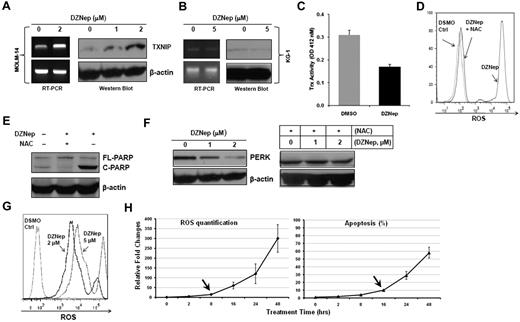 Figure 4. DZNep treatment increased TXNIP expression and ROS production. TXNIP expression was determined by RT-PCR and Western blot analysis in MOLM-14 (A) and KG-1 (B) cells treated with either DMSO control or DZNep for 24 hours. (C) Trx activity in MOLM-14 cells treated with DMSO control or 2μM DZNep for 48 hours was measured at 412nM. Three separate measurements were indicated as mean ± SD. (D) FACS analysis of ROS production in MOLM-14 cells treated with DMSO control, DZNep, or NAC + DZNep. (E) Western blot analysis of cleaved PARP. (F) MOLM-14 cells were treated with DMSO control, DZNep 1μM or 2μM for 48 hours with or without NAC. Cells were washed, lysed, and subjected to Western blot analysis of PERK. β-actin was used as a loading control. (G) One representative FACS profile of ROS production in one CD34+CD38− leukemia early progenitor cells treated with DZNep. (H) FACS analysis of ROS production (left panel) and apoptosis (right panel) in MOLM-14 cells treated with DZNep 2μM in a time-dependent manner. The amount of ROS production and apoptosis in treated samples were normalized to that of baseline in the control samples (0 hours). Three separate measurements were indicated as mean ± SD. Arrows indicate the starting time point when ROS and apoptosis were significantly increased, respectively.