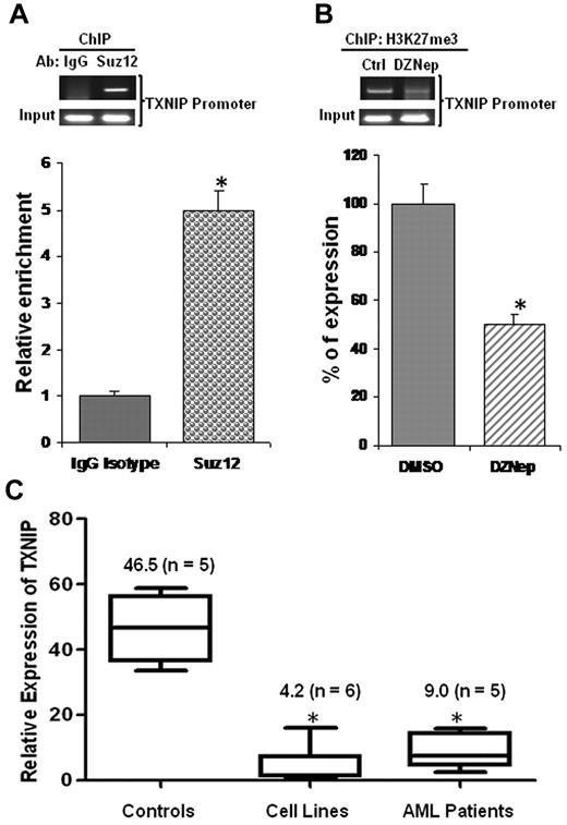 Figure 6. PRC2 complex binds TXNIP promoter and TXNIP is repressed in AML. (A) ChIP assays were performed in MOLM-14 cells using Abs against Suz12 or a negative control IgG and analyzed by RQ-PCR amplifying a region of −250 to −121 relative to transcription start site of TXNIP promoter. The relative enrichments of PRC2 complex in the TXNIP promoter region were normalized to isotype controls. The experiments were conducted in triplicates (mean ± SD). (B) MOLM-14 cells treated with DMSO control or DZNep 2μM for 48 hours. ChIP assays were conducted using Ab against H3K27me3. The relative reductions were shown in mean ± SD of triplicate measurement. (C) Real-time qRT-PCR analysis of TXNIP expression in healthy controls, AML cell lines, and primary AML patient cells. The expression of TXNIP in TF-1 cells was set as 1 (baseline), which is the lowest among the 6 cell lines tested. The average of CT value of TXNIP in TF-1 sample was 24 ± 0.5. The numbers in the brackets indicate the sample size.