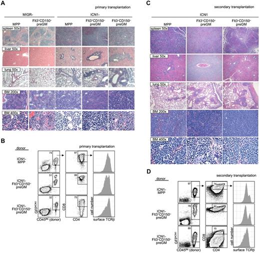 Figure 5. Flt3+CD150– preGMs are susceptible to ICN1-medated T-ALL. Flt3+CD150–, Flt3–CD150– preGMs, and MPPs were sorted from WT B6 BM (CD45B6) and transduced with either control-MIGR or ICN1-MIGR retrovirus for 2 days. Live transduced GFP+ cells (5000) from each group of cells were intravenously transferred into sublethally irradiated recipients (CD45SJL). Recipient mice were assessed regularly for signs of cachexia. (A) Cachectic mice with peripheral WBC count > 5 × 106/mL were promptly killed and various organs were harvested and prepared for histology study. Shown are representative H&E staining of spleen, liver, lung, and BM from mice that received empty MIGR-transduced MPPs and Flt3+CD150− and ICN1-transduced MPPs, Flt3+CD150−, and Flt3−CD150−. Magnification is as indicated. (B) BM cells (5 × 105) from mice that received ICN1-transduced progenitors in panel A were intravenously transferred to sublethally irradiated secondary recipients (CD45SJL). Shown are representative flow cytometry analysis of primary BM cells used in transfer. (C) The secondary recipient mice were monitored for signs of cachexia. Cachectic mice were killed. Shown are representative H&E staining of spleen, liver, lung, and BM from secondary mice that received BM cells from panel B. Magnification is as indicated. (D) Flow cytometric analysis of BM cells from secondarily transplanted mice that received BM from panel B. Results shown are from 2 independent experiments. n = 4-5.