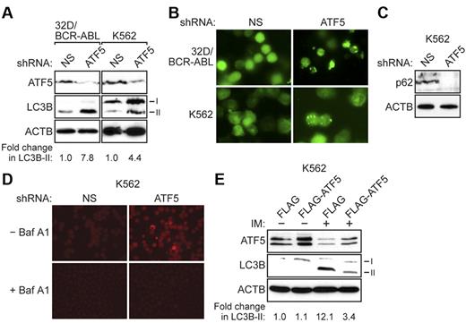 Figure 2. ATF5 inhibits autophagy in BCR-ABL–transformed cells. (A) 32D/BCR-ABL or K562 cells treated with either a NS or ATF5 shRNA were monitored for expression of ATF5 and LC3B by immunoblot analysis. β-actin (ACTB) was monitored as a loading control. The fold change in LC3B-II levels on ATF5 knockdown was quantified by measuring the intensity of the LC3B-II signal in the immunoblots and normalizing to ACTB levels. (B) 32D/BCR-ABL or K562 cells ectopically expressing a GFP-LC3B fusion protein were treated with either a NS or ATF5 shRNA and analyzed by fluorescence microscopy. Representative images are shown. (C) Immunoblot analysis of p62 levels in K562 cells expressing a NS or ATF5 shRNA. (D) K562 cells expressing a NS or ATF5 shRNA were stained with acridine orange in the absence or presence of bafilomycin A1 (Baf A1). (E) Immunoblot analysis of ATF5 and LC3B levels in K562 cells stably expressing FLAG or FLAG-ATF5, and treated in the absence or presence of imatinib (IM; 10μM for 48 hours).