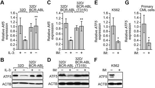 Figure 3. BCR-ABL regulates ATF5 expression independent of IL-3. (A) qRT-PCR analysis monitoring Atf5 expression in 32D or 32D/BCR-ABL cells cultured in the presence or absence of IL-3. Error bars represent SD. (B) Immunoblot analysis of ATF5 levels in 32D or 32D/BCR-ABL cells cultured in the presence or absence of IL-3. (C) qRT-PCR monitoring Atf5 expression in 32D/BCR-ABL or 32D/BCR-ABL(T315I) cells treated in the absence or presence of imatinib (10μM for 16 hours). Error bars represent SD. (D) Immunoblot analysis of ATF5 levels in 32D/BCR-ABL or 32D/BCR-ABL(T315I) cells in the absence or presence of imatinib (10μM for 16 hours). (E) qRT-PCR analysis monitoring ATF5 expression in K562 cells treated with or without imatinib (10μM for 48 hours). Error bars represent SD. (F) Immunoblot analysis of ATF5 levels in K562 cells treated with or without imatinib (10μM for 48 hours). (G) qRT-PCR monitoring of ATF5 expression in human peripheral blood cells isolated from chronic-phase CML patients (n = 3). Cells were treated in the absence or presence of imatinib (10μM for 16 hours). Error bars represent SE. *P < .05; **P > .05.