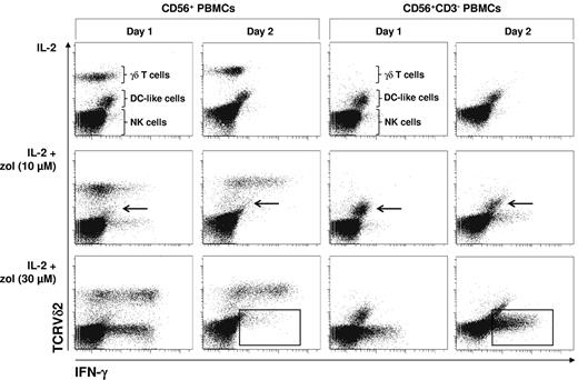 Figure 5. γδ T cell–dependent elimination of DC-like cells terminates NK cell IFN-γ production induced by zoledronate. CD56+ PBMCs or CD56+CD3− PBMCs (2 × 106/mL) were stimulated with either IL-2 alone (100 U/mL) or with bisphosphonate (10 or 30μM) plus IL-2. On days 1 and 2, cells were stained for intracellular IFN-γ and for surface TCRVδ2 (γδ T lymphocytes). Arrows point out DC-like cells surviving in the absence but not in the presence of γδ T lymphocytes. Frames point out NK cells that terminate IFN-γ production in the presence of γδ T lymphocytes but continue to produce IFN-γ in the absence of γδ T lymphocytes. Results are representative of 3 independent experiments.