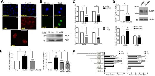 Figure 3. LANA and Kaposin B down-regulate miR-221 and miR-222 levels, resulting in modulation of EC motility. (A) Immunofluorescence staining for LANA proteins. HMEC1 cells with stable LANA expression or the vector control were fixed, and LANA protein was detected by anti-LANA mAb, followed by anti–rat IgG secondary antibody conjugated with rhodamine (red). An enlarged LANA staining pattern is shown in the bottom panel. (B) Immunofluorescence staining and immunoblotting for Kaposin B proteins. HMEC1 cells with stable Kaposin B expression or the vector control were fixed, and Kaposin B proteins were detected by anti-Flag mAb, followed by anti–mouse IgG secondary antibody conjugated with FITC (green). Note that Kaposin B is expressed in the nucleus. Scale bar represents 25 μm. Immunoblotting of Kaposin B proteins with anti-Flag mAb is shown. Actin was used as an internal control (bottom panel). (C) Both LANA and Kaposin B can repress the expression of miR-221 and miR-222. HMEC1 cells with stable LANA (top panel) or Kaposin B (bottom panel) expression were used to detect the expression levels of miR-221 and miR-222 by qRT-PCR. (D) Knocking down LANA expression in HK cells resulted in the restoration of the miR-221 level, but not the level of miR-222. HK cells electroporated with siLANA or siGFP control siRNA were subjected to the Transwell cell-migration assay (top panel; n = 2) and also used to detect the expression level of miR-221 and miR-222 (bottom panel). (E) LANA- or Kaposin B–induced cell migration is countered by miR-221/miR-222. HMEC1 cells with stable LANA (left panel) or Kaposin B (right panel) expression were transduced with vector or the miR-221/miR-222 cluster, and then the cells were subjected to the Transwell cell-migration assay (n = 3). (F) LANA and Kaposin B individually repress miR-221/miR-222 expression by targeting the promoter region. miR-221/miR-222 promoter reporter assays were performed by transfection with different promoter fragments inserted into luciferase reporter plasmids in stably LANA- or Kaposin B–expressing 293T cell lines. Note that LANA and Kaposin B repress miR-221/miR-222 promoter activity by targeting different regions of the promoter, namely the −150 to −200 bp and the −200 to −600 bp regions, respectively (n = 3).