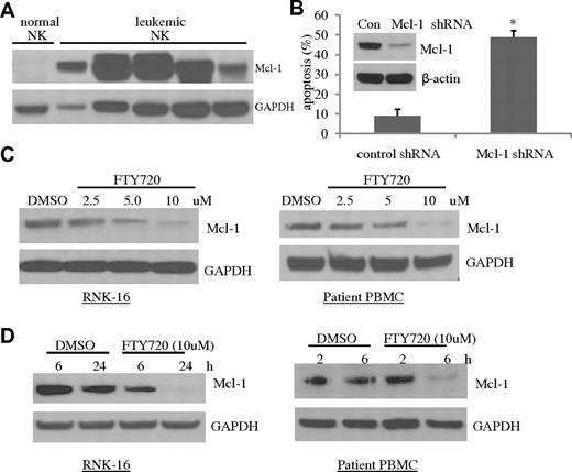 Figure 2. Mcl-1 plays an essential role in survival of leukemic NK cells and is degraded by FTY720. (A) Increased expression of Mcl-1 in NK-cell leukemia. Proteins were isolated from PBMCs of 5 individual patients with chronic NK-cell leukemia (CD3−CD56+ cells > 80%), or pooled enriched NK cells (CD3−CD56+ 80%-95%) from 10 normal human donors, then resolved in the SDS-PAGE gel loading buffer in a boiling water bath for 5 minutes. Western blot analysis was performed for detection of Mcl-1. GAPDH was used as a loading control. (B) Knockdown of Mcl-1 induces apoptosis in leukemic NK cells. Human NKL cells were infected with the concentrated PLKO.1 Mcl-1 shRNA or scramble shRNA lentiviral stocks for 48 hours, and then apoptosis assay was performed. *P < .05 indicates significant difference in apoptosis of Mcl-1 shRNA-infected cells compared with control shRNA-infected cells (Student t test). (Inset) Western blot analysis was performed for Mcl-1 in the control shRNA or Mcl-1 shRNA-infected NKL cells 48 hours after infection. The equal loading of protein was confirmed by probing with GAPDH Ab. (C) Dose-dependent reduced expression of Mcl-1 after FTY720 treatment. Western blot analysis was performed for Mcl-1 after 24-hour treatment of RNK-16 cells or PBMC cells from an NK-cell leukemia patient, with 2.5, 5, and 10μM FTY720. Data are representative of 3 independent experiments on RNK-16 cells or PBMCs from 3 chronic NK-cell leukemia patients. (D) Time-dependent decreased expression of Mcl-1 after FTY720 treatment. Western blot analysis was performed for Mcl-1 after treatment of RNK-16 cells with 10μM FTY720 for 6 and 24 hours, or PBMC cells from an NK-cell leukemia patient with 5μM FTY720 for 2 and 6 hours. Data are representative of 3 independent experiments on RNK-16 cells or PBMCs from 3 chronic NK-cell leukemia patients.