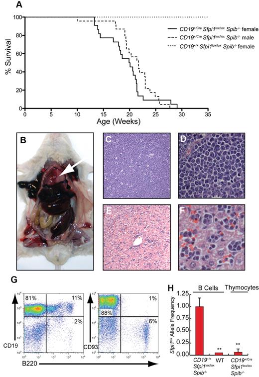 Figure 5. Pre-B ALL with thymic involvement in CD19+/CreSfpi1lox/loxSpib−/− mice. (A) Kaplan-Meier survival plot for aging mice of the indicated genotype and sex. (B) Enlarged thymus (arrow), enlarged spleen, and enlarged liver are shown in a moribund CD19+/CreSfpi1lox/loxSpib−/− mouse. (C) Histology of the thymus in a moribund CD19+/CreSfpi1lox/loxSpib−/− mouse (original magnification ×4). (D) Enlargement of thymic section shown in panel C, original magnification ×60. (E) Histology of the liver in moribund CD19+/CreSfpi1lox/loxSpib−/− mice. (F) Enlargement of liver section shown in panel E to demonstrate the presence of lymphocytes in sinusoids, original magnification ×60. (G) High frequency of immature B cells in the thymus of a moribund CD19+/CreSfpi1lox/loxSpib−/− mouse. Flow cytometric analysis was performed to determine the frequency of cells expressing the indicated cell surface markers in the thymus of a moribund CD19+/CreSfpi1lox/loxSpib−/− mouse. (H) Measurement of Sfpi1lox allele frequencies in thymic pre-B cells. qPCR was performed to determine the relative frequency of intact Sfpi1lox alleles in pre-B cells from the thymus of a moribund CD19+/CreSfpi1lox/loxSpib−/− mouse (right bar). As a control, the Sfpi1lox allele frequency in splenic B cells enriched from an 8-week-old CD19+/+Sfpi1lox/loxSpib−/− mice was determined and set to 1.00 (left bar). qPCR also was performed on C57Bl/6 B cell genomic DNA (center bar) as an additional negative control to demonstrate specificity of the qPCR reaction.