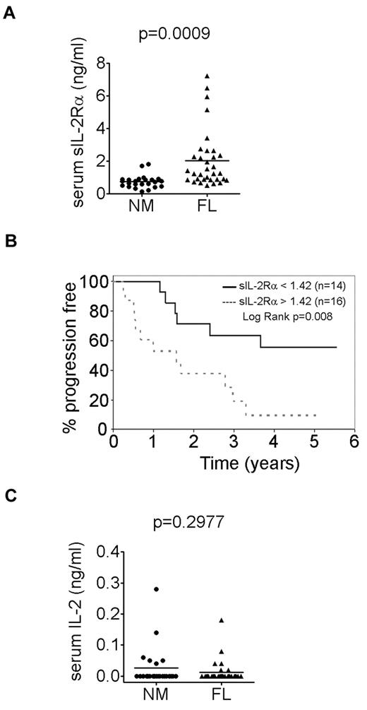 Figure 2. sIL-2Rα serum levels in FL correlates with poor survival. (A) sIL-2Rα serum levels measured by multiple ELISA (Luminex) in untreated FL patients (median: 2.03 ± 0.31 ng/mL, n = 33) and healthy donors (median: 0.74 ± 0.08 ng/mL, n = 24). (B) A Kaplan-Meier curve for progression-free survival by serum levels of sIL-2Rα in FL patients with a cutoff of 1.42 ng/mL (n = 30). (C) IL-2 serum levels measured by multiple ELISA (Luminex) in untreated FL patients (median: 0.024 ng/mL, n = 30) and healthy donors (median: 0.035 ng/mL, n = 22).