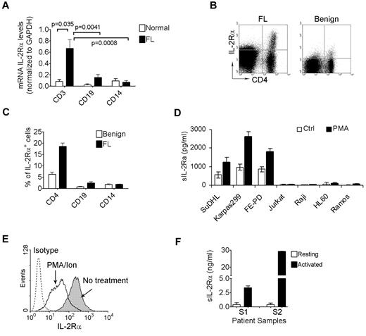 Figure 3. Production of sIL-2Rα in FL patients. (A) mRNA levels of IL-2Rα measured by quantitative RT-PCR. CD3+ T cells, CD19+ B cells, or CD14+ monocytes were isolated from biopsy specimens of FL (n = 12) or peripheral blood of normal individuals (n = 5). mRNA levels were normalized to GAPDH. (B) A representative sample (n = 15) showing surface expression of IL-2Rα on CD4+ T cells from FL (left) and benign lymph node (right). (C) Summary of the numbers of IL-2Rα–expressing cells in subsets of CD4+ T cells, CD19+ B cells, or CD14+ monocytes from FL (n = 10) and benign lymph nodes (n = 5). (D) A graph showing sIL-2Rα levels measured by ELISA in culture supernatants of cell lines treated with or without PMA/Ion. (E) Surface expression of IL-2Rα by flow cytometry on Karpas299 cells treated with or without PMA/Ion. (F) A graph showing sIL-2Rα levels measured by ELISA in culture supernatants of resting and activated CD4+ T cells from 2 patient samples.