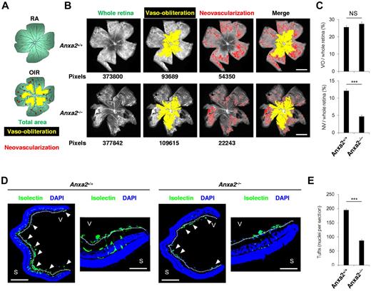 Figure 1. The annexin A2 system promotes retinal neoangiogenesis in OIR. (A) Schematic diagram showing areas occupied by total retina (green), regions of vaso-obliteration (yellow), and regions of neovascularization (red) in mice maintained in room air (RA) or treated with oxygen from P7 to P12 (OIR). (B) Representative retinal images showing total retinal area and regions of vaso-obliteration and neovascularization in P17 oxygen-treated Anxa2+/+ and Anxa2−/− mice. Pixel number corresponding to each compartment is indicated below each image. (C) Ratios of vaso-obliterative (VO) to total retinal area (25.6% ± 1.0% vs 27.5% ± 1.1%) and neovascular (NV) to total retinal area (12.1% ± 0.5% vs 4.7% ± 0.4%) in oxygen-treated P17 Anxa2+/+ (n = 7) and Anxa2−/− (n = 9) mice (NS indicates no significant difference; ***P < .001). (D) Representative retinal cross-sections (magnification ×40), with close-up views of peripheral region (magnification ×200) of retinas from oxygen-treated P17 Anxa2+/+ and Anxa2−/− mice stained with DAPI (blue) and isolectin B4 (green). Neovascular tufts penetrating the inner limiting membrane (highlighted with a white dashed line) are indicated by arrowheads. (E) Enumeration of neovascular nuclei in retinal sections from P17 oxygen-treated Anxa2+/+ versus Anxa2−/− (194.5 ± 5.2; n = 8 vs 87.4 ± 4.6; n = 10; ***P < .001) mice. Scale bars, 200 μm (B; magnification ×50), 500 μm (D; magnification ×40), 100 μm (D; magnification ×200).