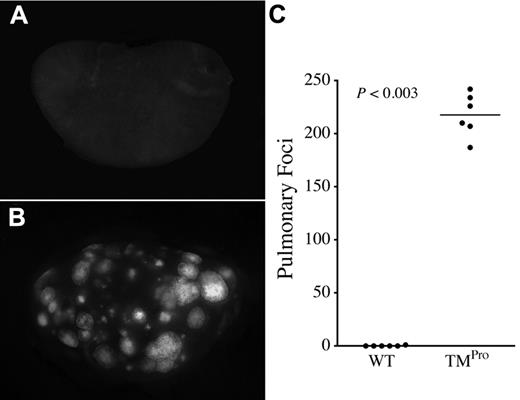 Figure 2. TMPro expression results in a large metastatic burden even after injection of a relatively low tumor cell burden. Gross appearance of lung lobes harvested from WT (A) and TMPro mice (B) 13 days after intravenous injection of 3 × 104 LLCGFP cells. (C) This modest tumor cell inoculum resulted in essentially no pulmonary metastases in WT mice, whereas TMPro mice developed hundreds of metastatic foci. Horizontal bars represent medians.