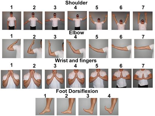 Figure 2. Documenting range of motion. Beginning with the full (normal) range of motion on the right, the images indicate progressively more limited range of motion as the numeric scores decrease toward maximally restricted joint motion. By row, from top to bottom, the tasks being attempted are: full shoulder abduction with upper arms brought next to ears, full elbow extension with arms outstretched, “Buddha Prayer” position, and full ankle dorsiflexion.