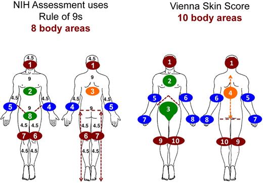 Figure 4. Comparison of body areas used in NIH and VSS.