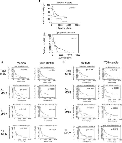 Figure 5. Association of MSI2 expression with outcome. (A) Kaplan-Meier survival analysis based on manually measured cytoplasmic or nuclear H-scores, showing significant association with outcome for nuclear H-scores. Patients with higher nuclear H-scores have poorer outcome (P = .0055) but lack association for cytoplasmic H-scores (P = .16); the patients were grouped by H-score into 2 groups, one with H-scores less than the 75th centile (quartiles 1-3) and one with H-scores equal to or above the 75th centile (quartile 4), with the first quartile used for the lower end of gene expression for each gene. (B) Kaplan-Meier survival analyses based on Aperio measured percentage of cells showing total cellular MSI2 positivity. Analyses are shown for 1+, 2+, or 3+ intensity of staining and using either the median or 75th centile to split the patients into 2 groups. Higher positivity for MSI2 was significantly associated with a poorer outcome at 3+ intensity of staining above either the median (P = .0069) or the 75th centile (P < .0001) and for 2+ intensity above the 75th centile; the most significant association was for patients with 3+ staining above or below the 75th centile (P < .0001), with patients in the fourth quartile having poorer outcome. (C) Kaplan-Meier survival analyses based on Aperio measured percentage of cells showing nuclear MSI2 positivity. Analyses are shown for 1+, 2+, or 3+ intensity of staining and using either the median or 75th centile to split the patients into 2 groups. Higher positivity for MSI2 was significantly associated with a poorer outcome at 3+ or 2+ intensity of staining above either the median (P = .0425 and P = .0353 for 3+ and 2+, respectively) or the 75th centile (P < .0001 and P = .0241 for 3+ and 2+, respectively) and for 1+ intensity above the 75th centile (P = .0318). The most significant association was for patients with 3+ staining above or below the 75th centile (P < .0001), with patients in the fourth quartile having poorer outcome.