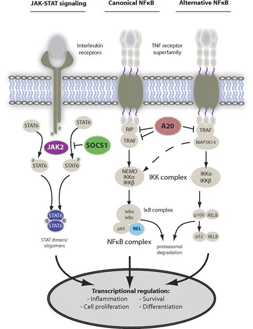 Figure 2. Main deregulated signaling pathways in PMBCL. The main activation cascades of JAK-STAT and NF-κB signaling. Alternative pathway activation exists. Known gene alterations leading to constitutive pathway activity in PMBCL are shown in color.