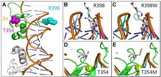 Figure 1. Mutations in GATA zinc finger domain. GATA zinc finger domains bind DNA in 2 conformations the adjacent and opposite forms. Here, we use the adjacent structure (3DFV).10 (A) Illustrated view of single GATA zinc finger (green) bound to DNA with adjacent GATA molecule in gray. R398 (cyan), T354 (magenta), and zinc ion (yellow) shown in space filling representation. (B) Wild-type R398 shown inserting into minor groove and possible H bonds with DNA bases. (C) R398W mutation modeled. (D) Wild-type T354. (E) T354M mutation modeled showing increased side chain size.